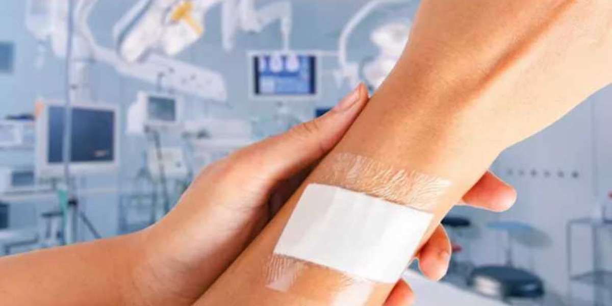 Global Medical Adhesives Market | Share | Size | Trends | Reports | Forecast | Growth | 2024 - 2032