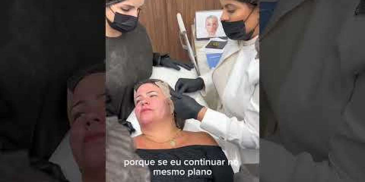 Peeling facial: qué es, para qué sirve y resultados del tratamiento